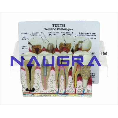 Teeth model w/descrip