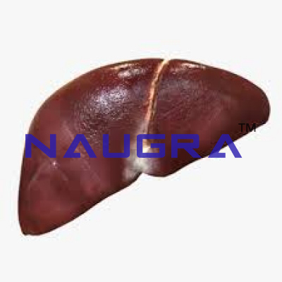 Model of human liver