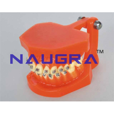 Metal bracket orthodonics model