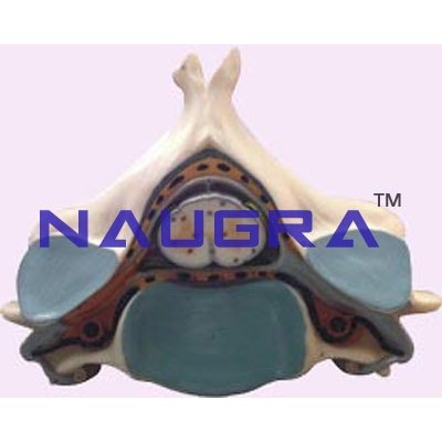 Fifth Cervical Vertebra