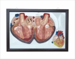 Relief model of human heart