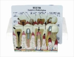Teeth model w/descrip