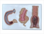 Relief model of large intestine