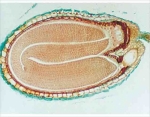 Capsella older embryo.sec.