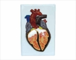 Relief model of heart