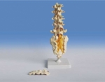 Lumbar spinal colum
