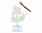 Model of Dentition