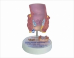 Model of hemorrhoid