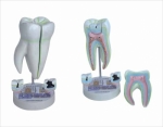 Human molar Teeth sma