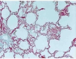 Lung with blood vessels injected