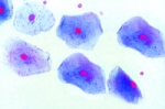 Simple squamous epithelium.w.m.