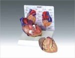 Heart model